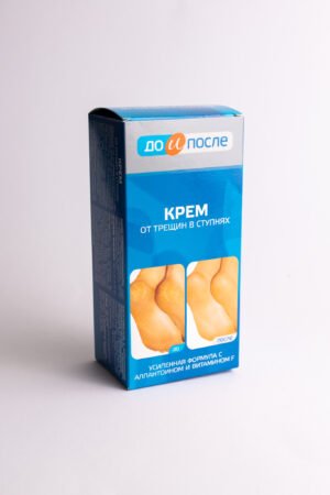 Prieš ir po: kremas nuo pėdų įtrūkimų, 50 ml