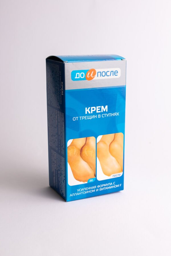 Prieš ir po: kremas nuo pėdų įtrūkimų, 50 ml